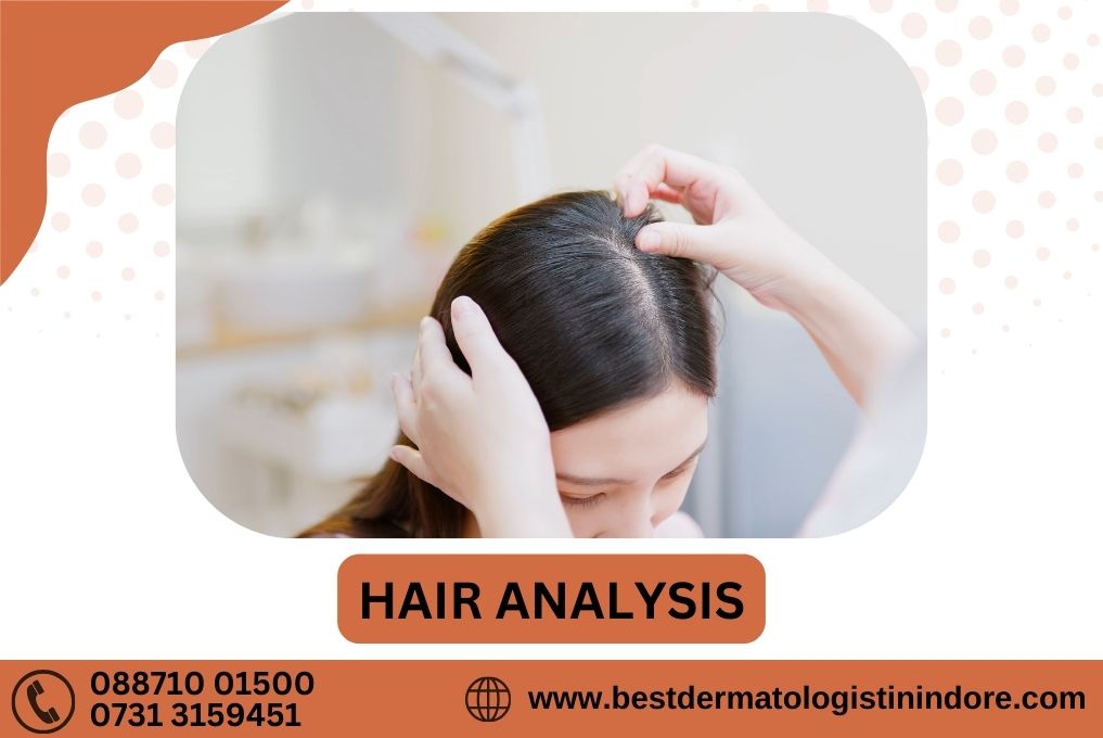 Hair Analysis Treatment in Indore