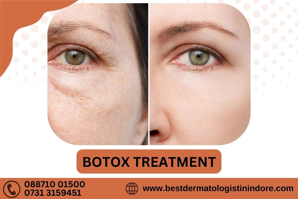 Best Botox Filler Treatment Specialist in Indore