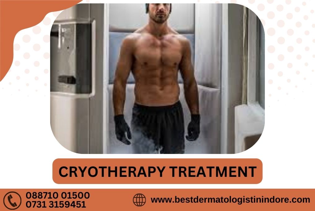 Cryotherapy Treatment in Indore