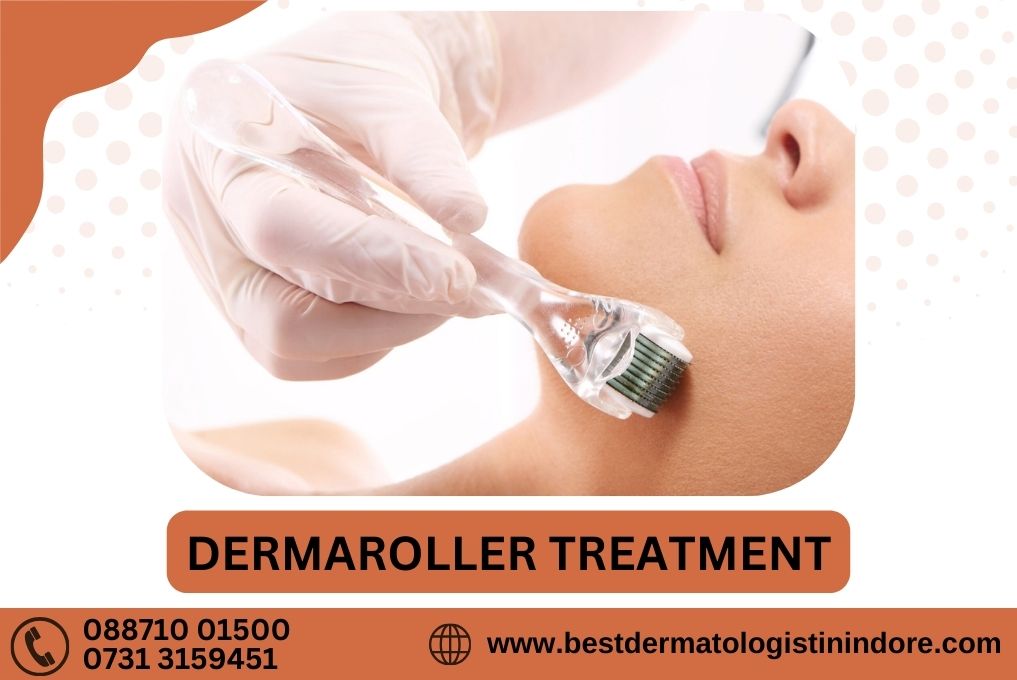 Derma Roller Treatment Specialist in Indore