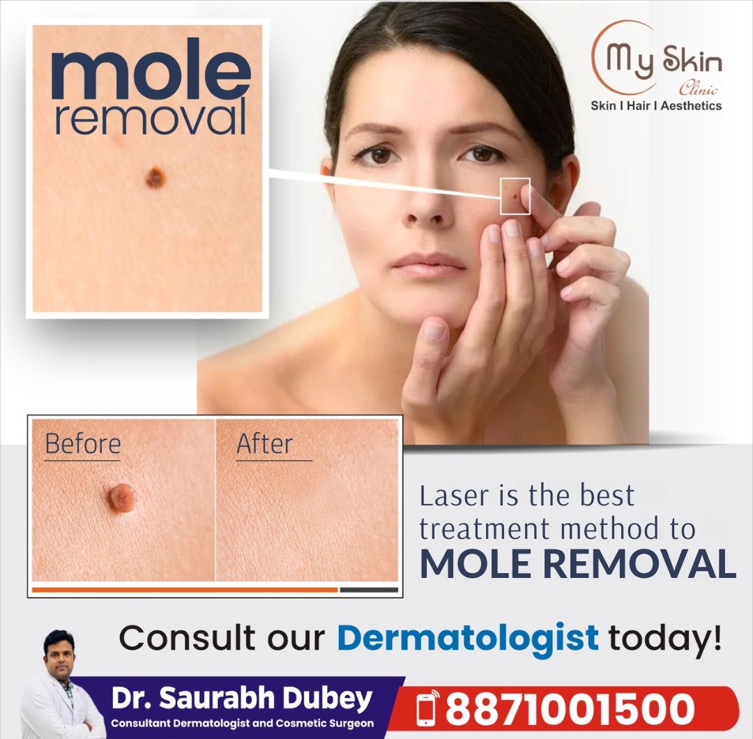 Best Skin Specialist in Indore