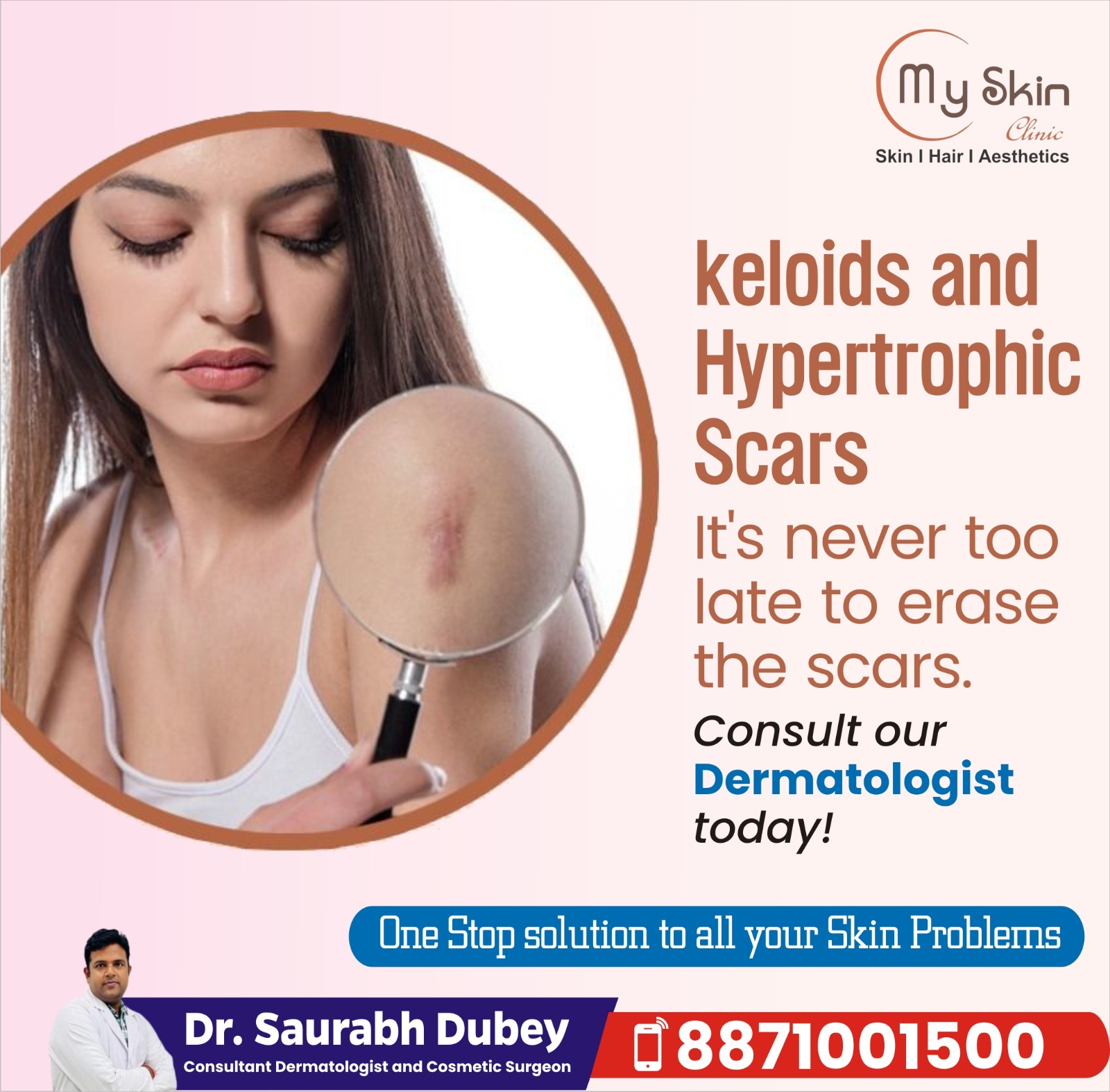 Best Doctor For keloids And Hypertrophic Scars In Indore