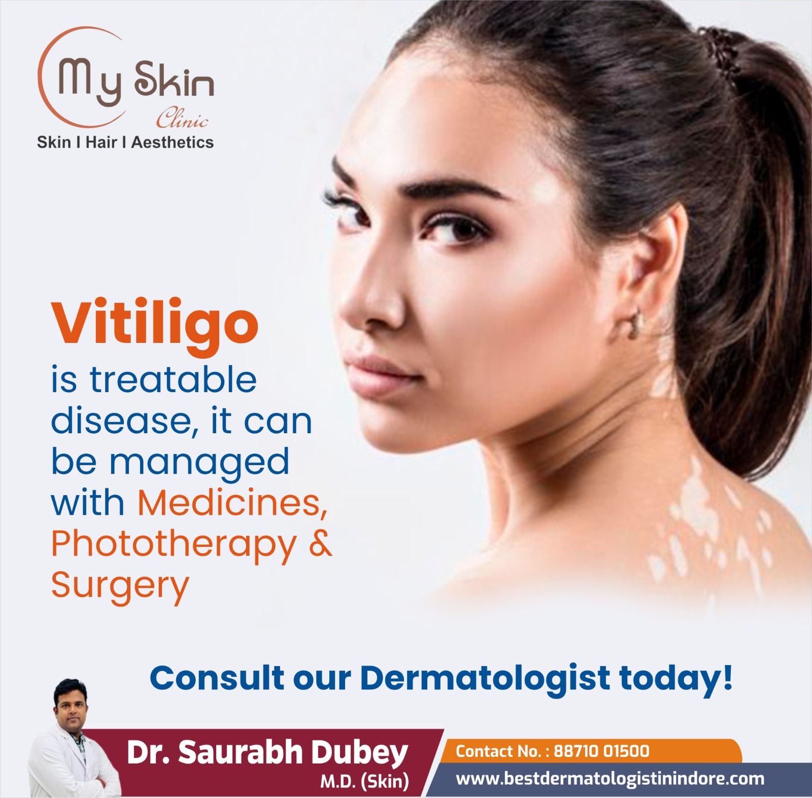 Best Skin Specialist for Vitiligo Treatment in Indore