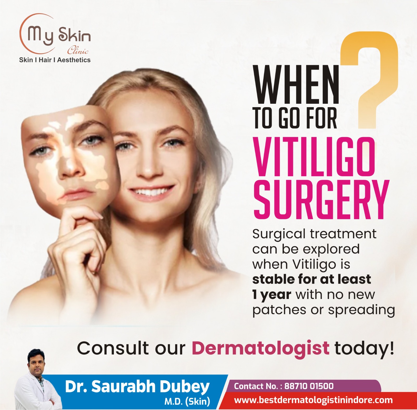 Best Skin Doctor for Vitiligo Treatment in Indore