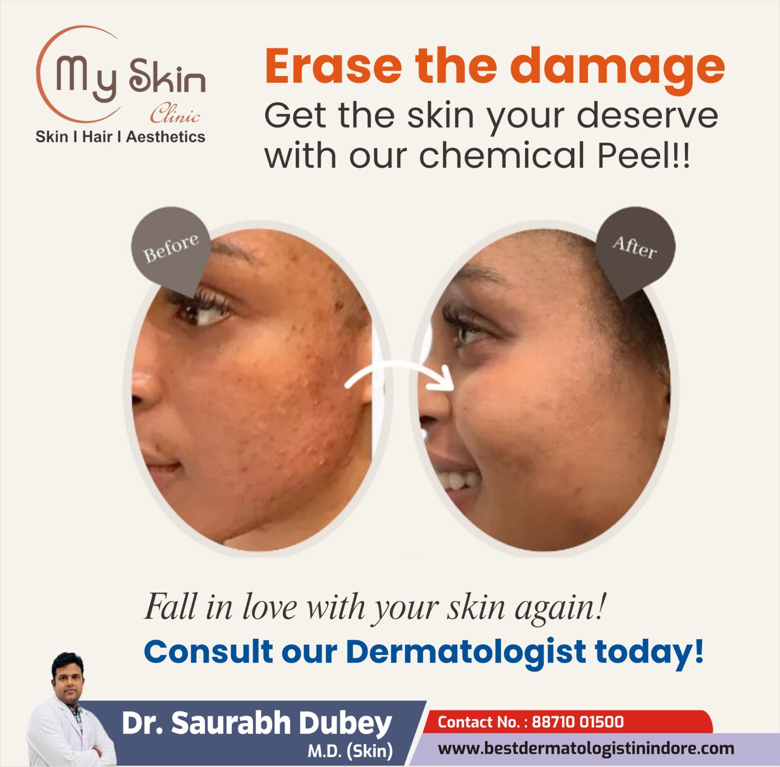 Best Skin Doctor in Indore