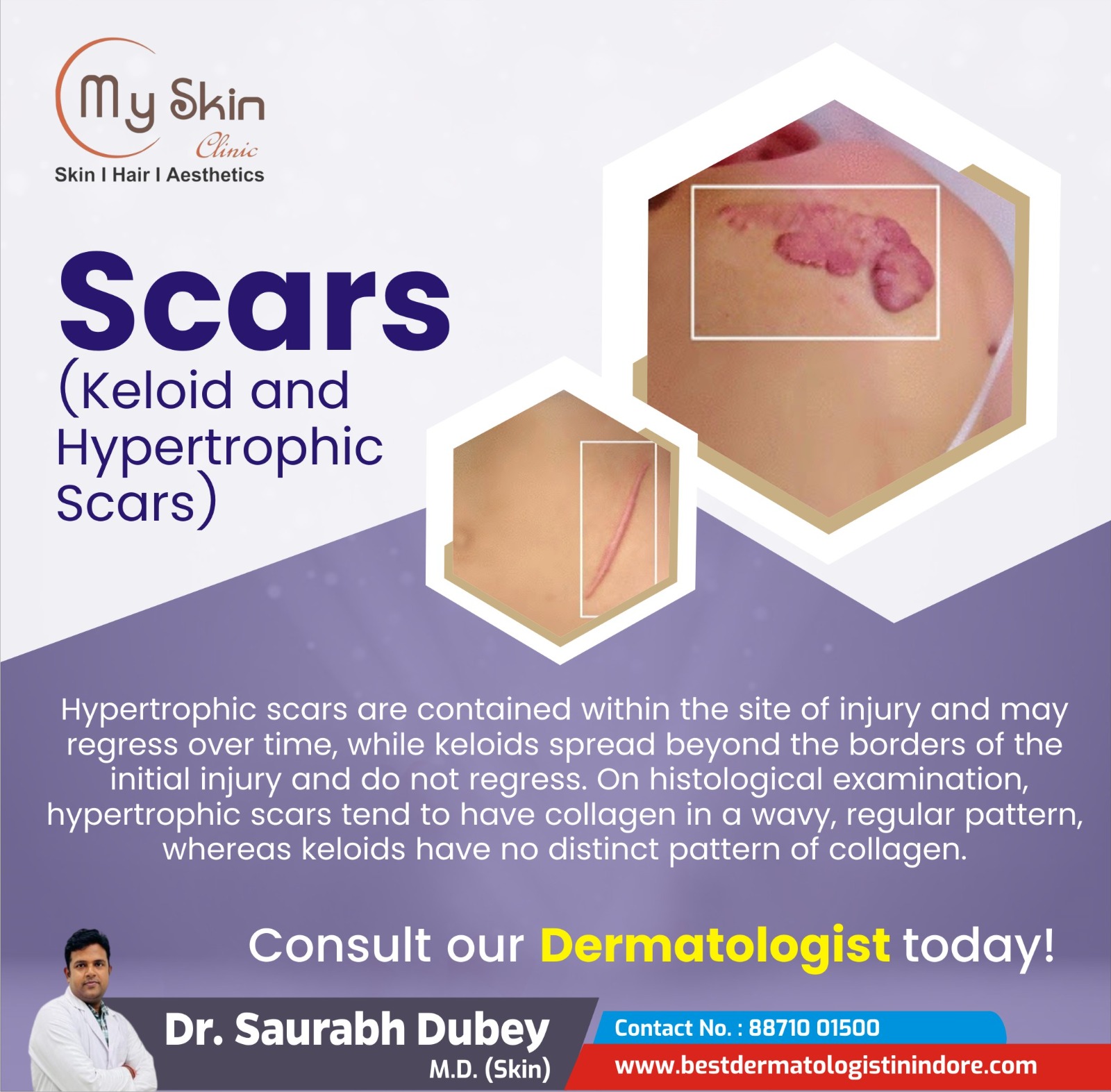 Best Skin Specialist in Indore