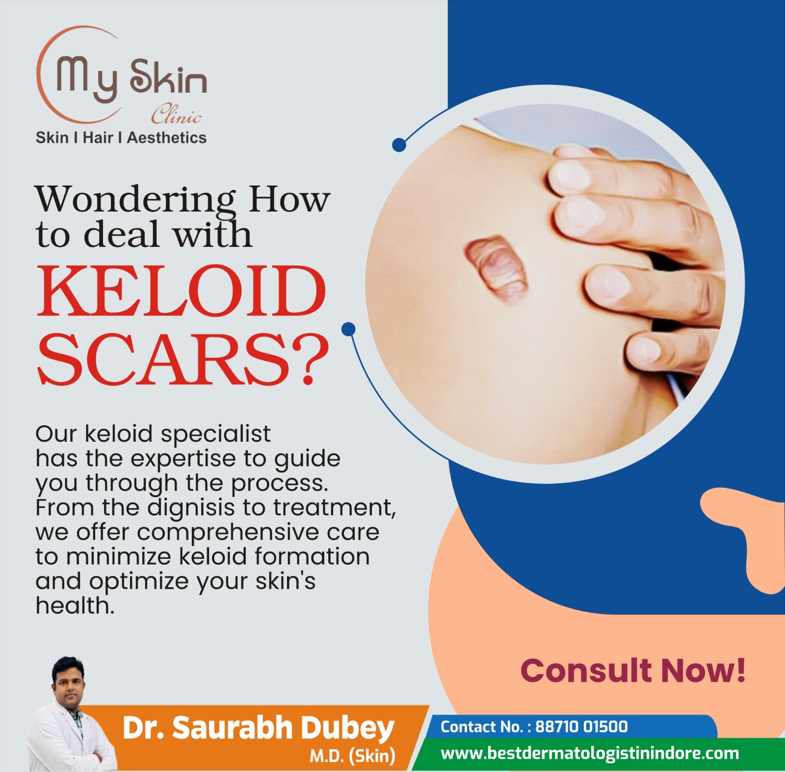 Best Skin Specialist for Keloid Scars Treatment in Indore