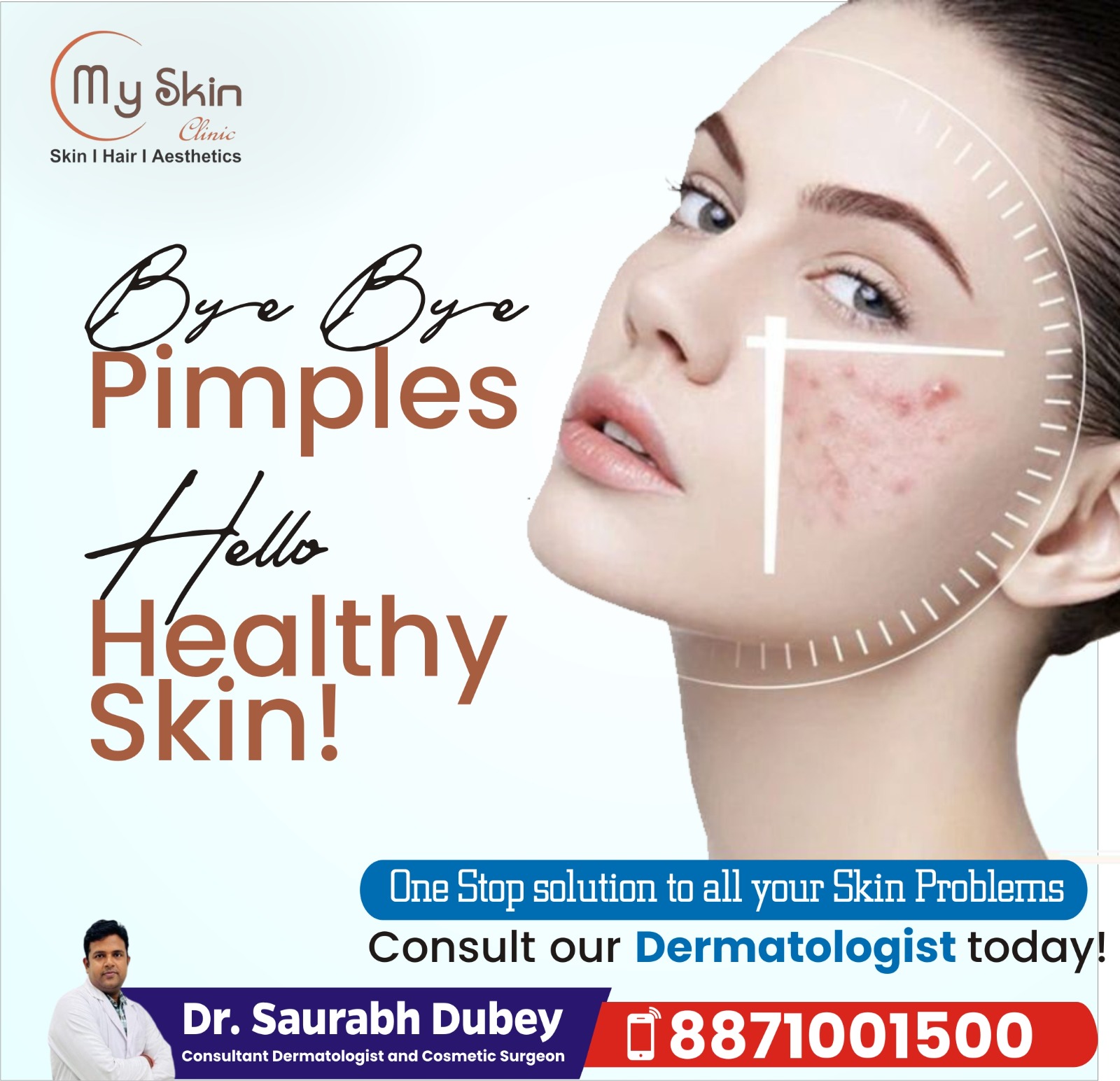 Best Acne Specialist in Indore