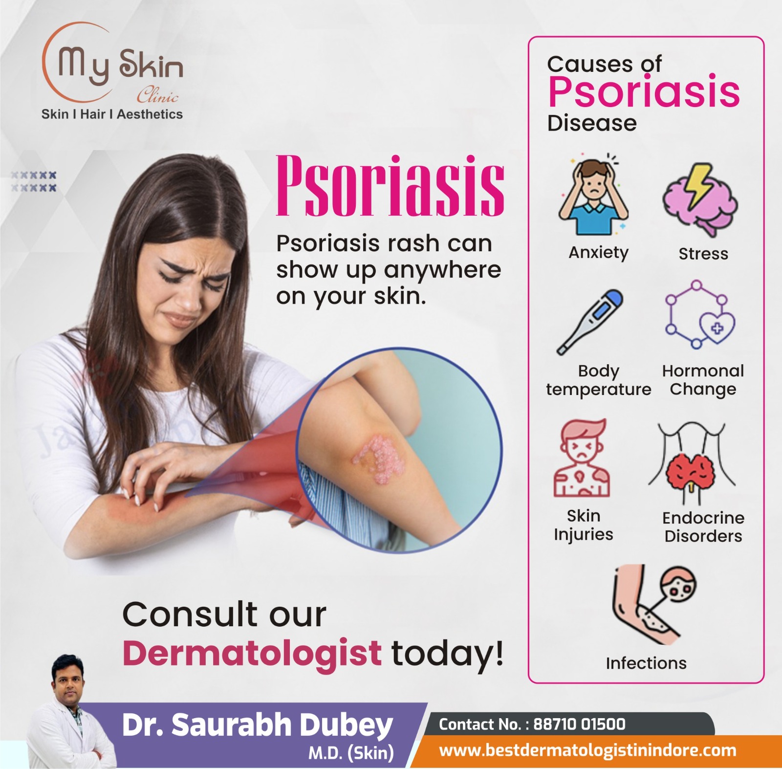 Best Skin Specialist for Psoriasis Treatment in Indore