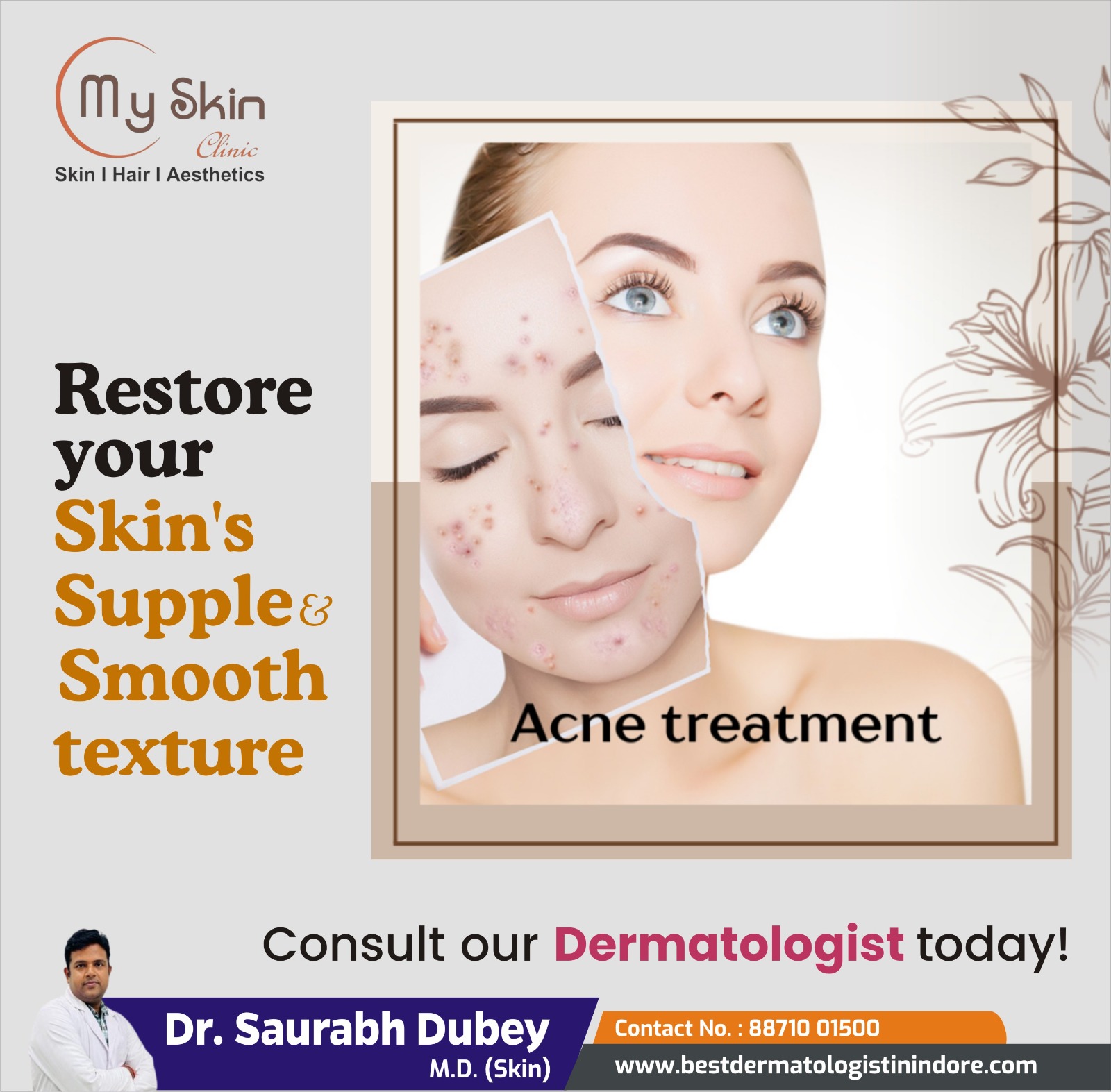 Best Skin Doctor for Acne Treatment in Indore