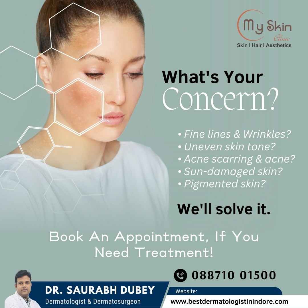 Best Skin Specialist in Indore