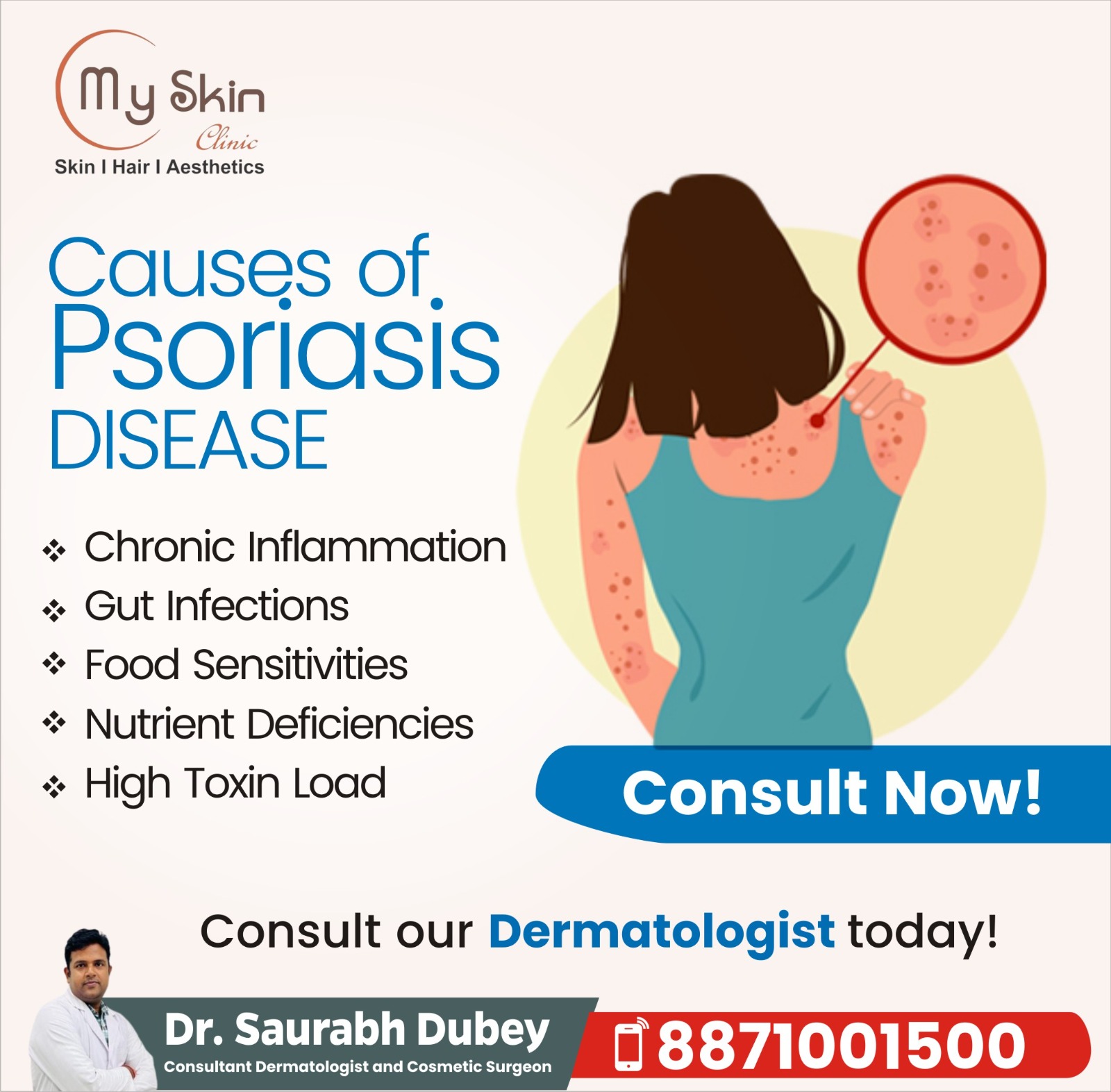 Best Skin Doctor for Psoriasis Treatment in Indore