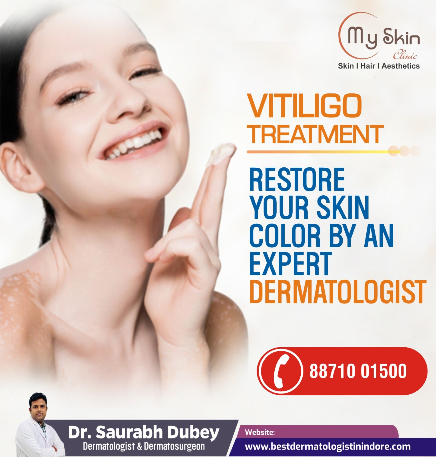 Best Skin Doctor for Vitiligo Treatment In Indore