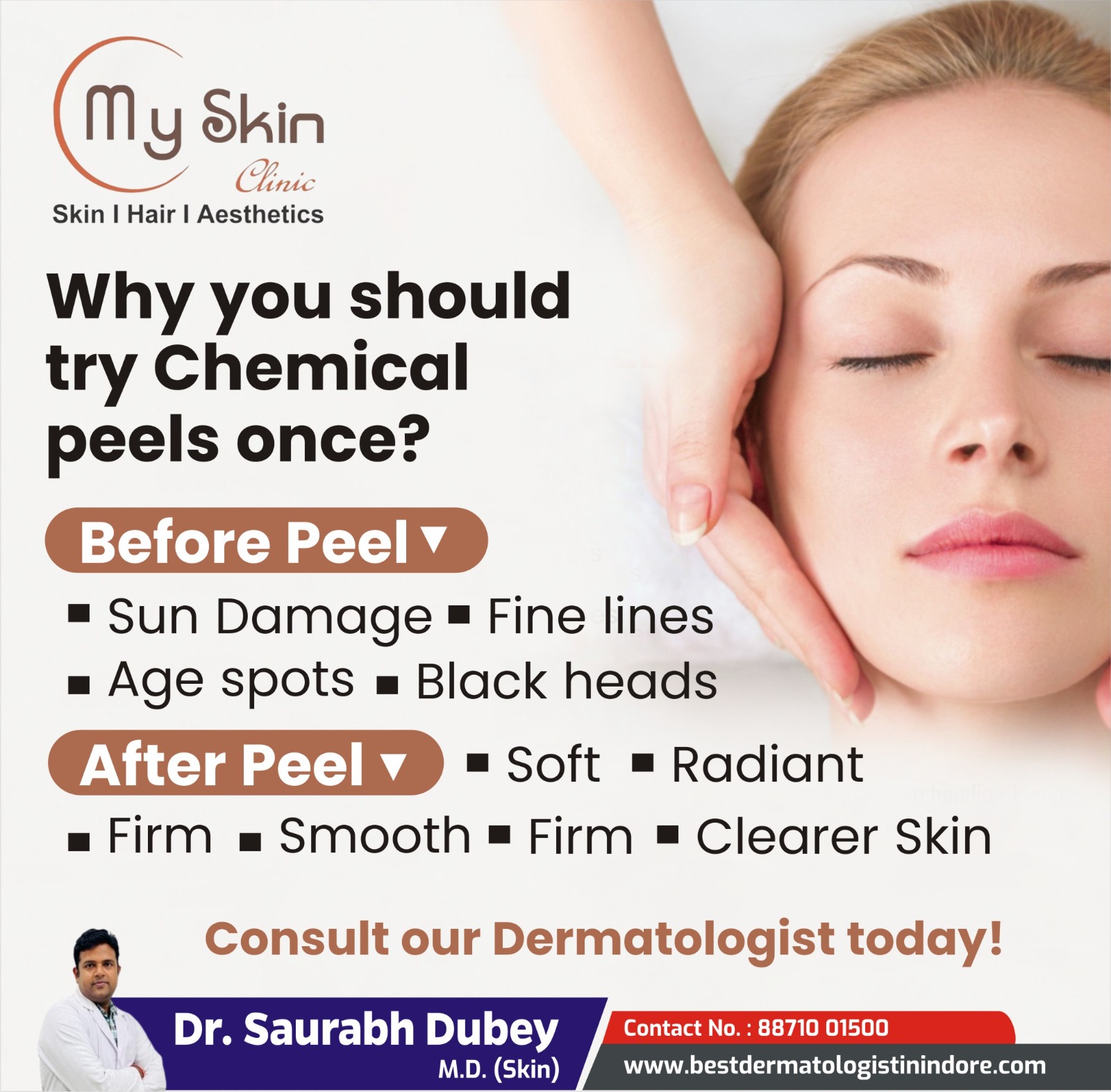 Best Skin Specialist for Chemical Peel Treatment in Indore