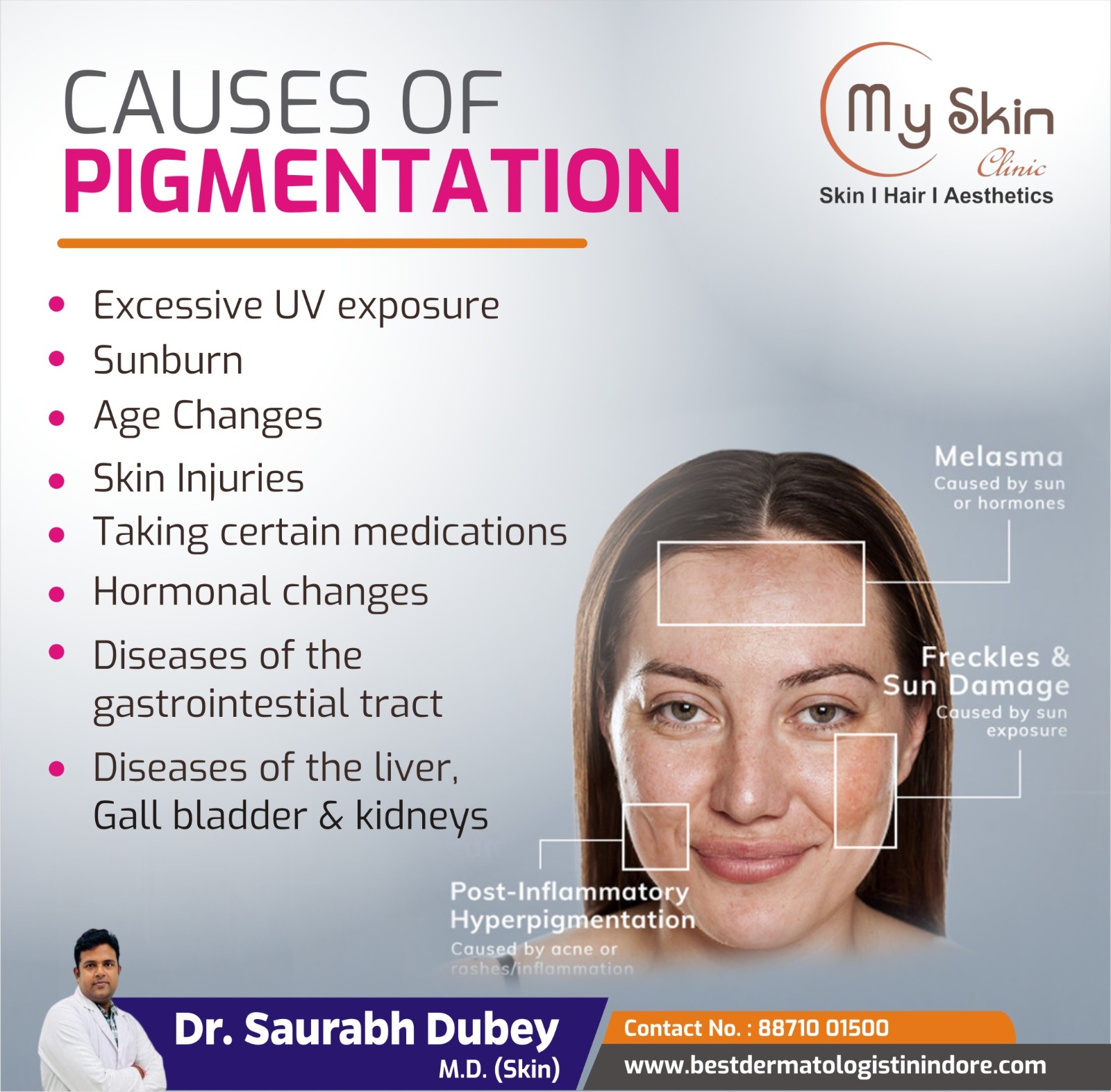 Best Skin Doctor for Hyperpigmentation Treatment in Indore