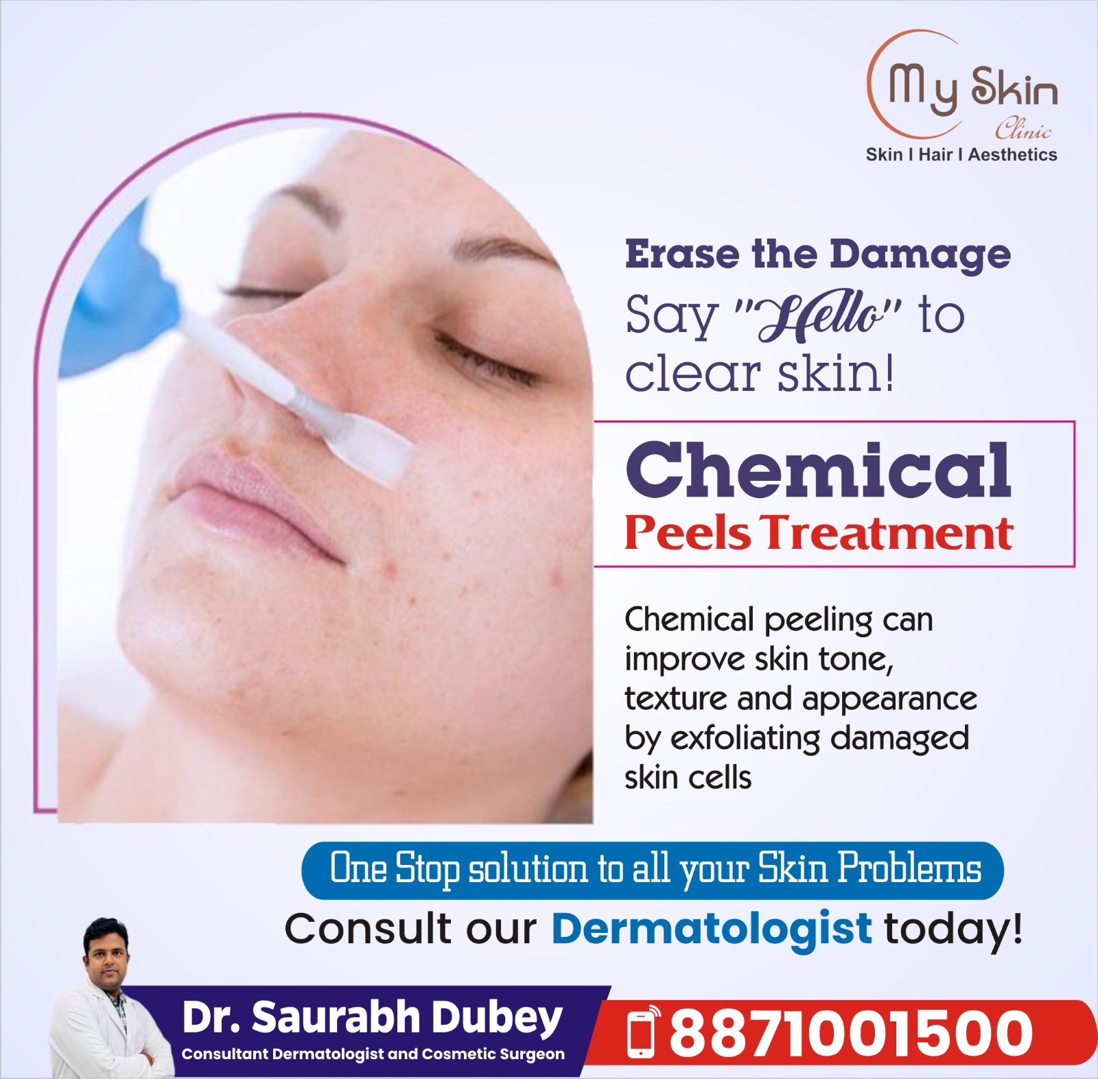 Best Chemical Peel Specialist in Indore 