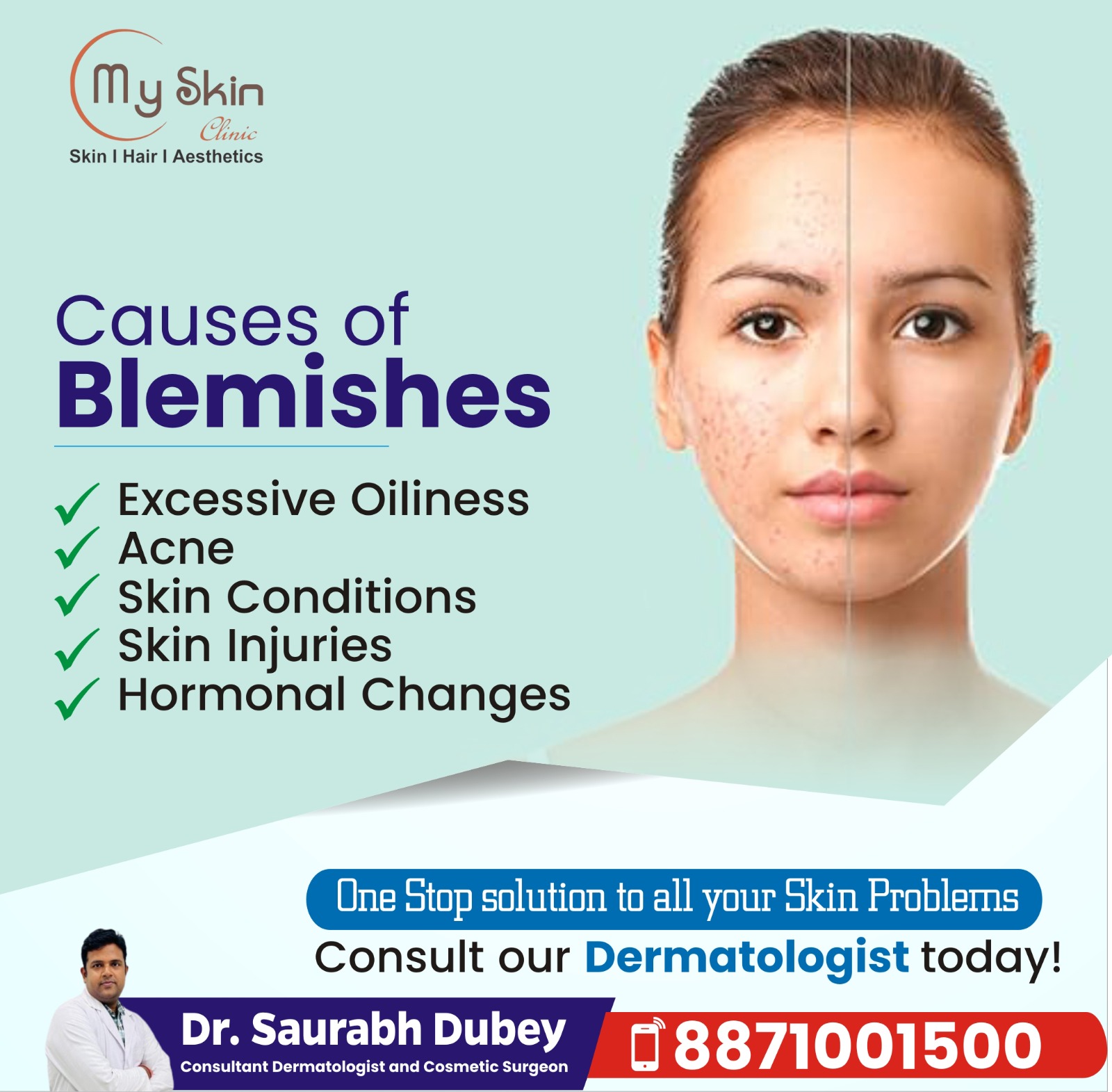 Best Doctor For Skin Treatment in Indore