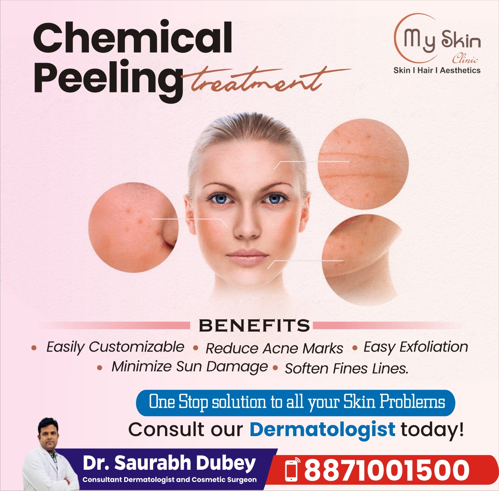 Best Dermatologist for Chemical Peel in Indore