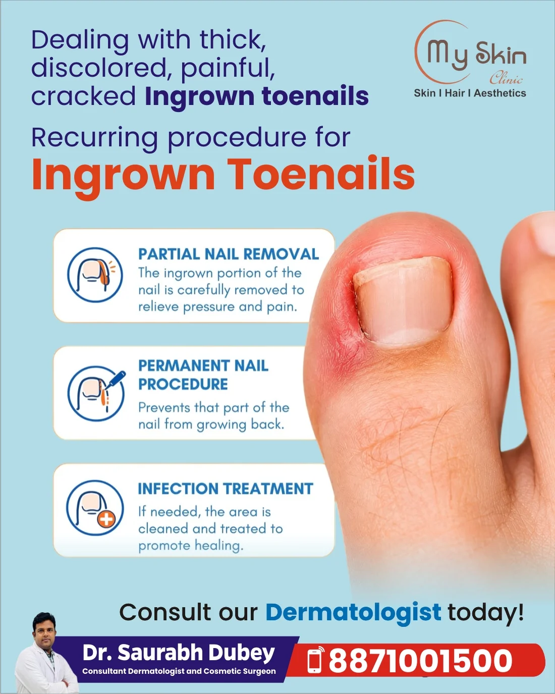 Ingrown Toenail Treatment in Indore: Care for Painful and Recurring Nail Problems