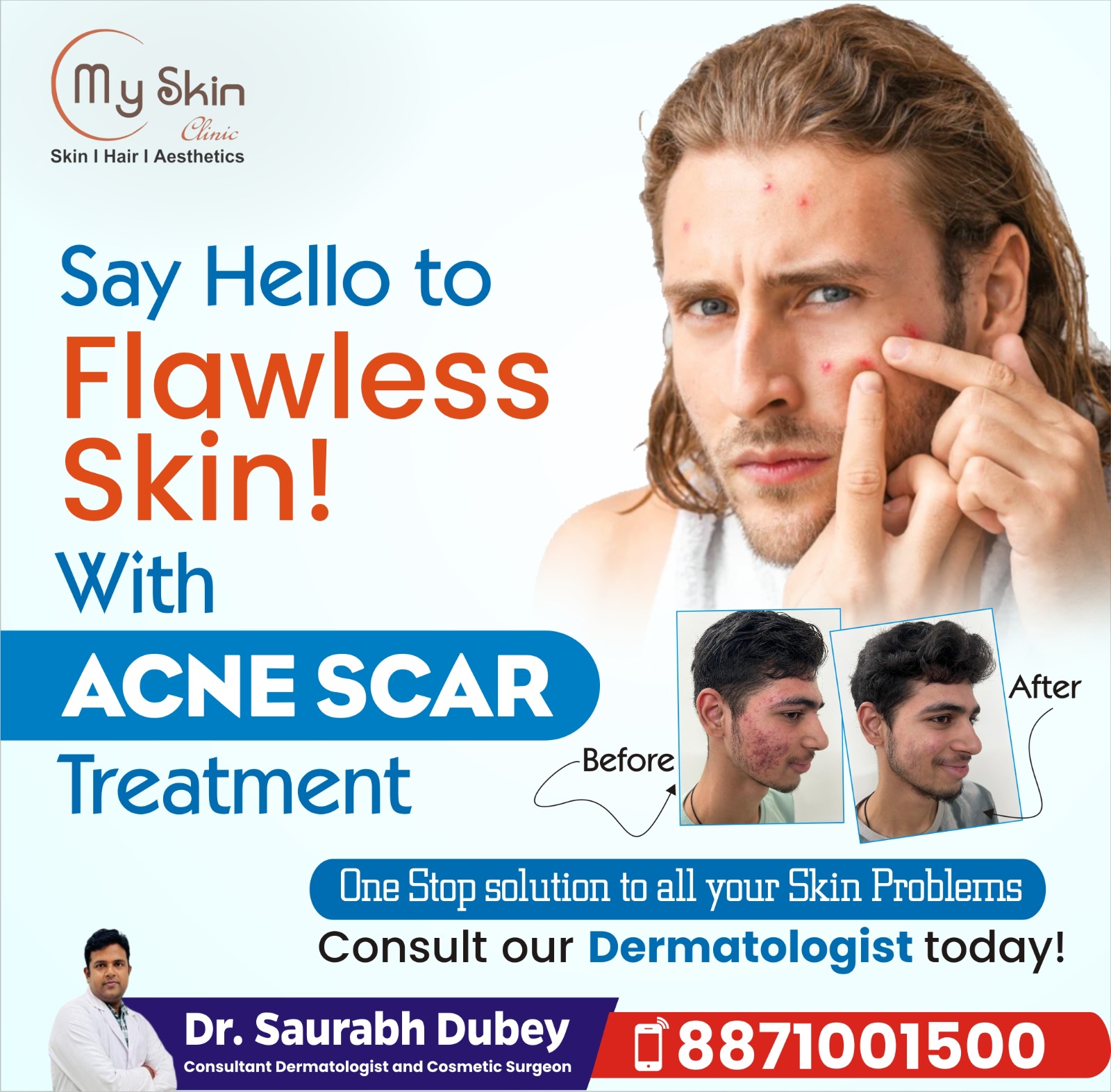 Best Doctor for Acne Scar Treatment in Indore