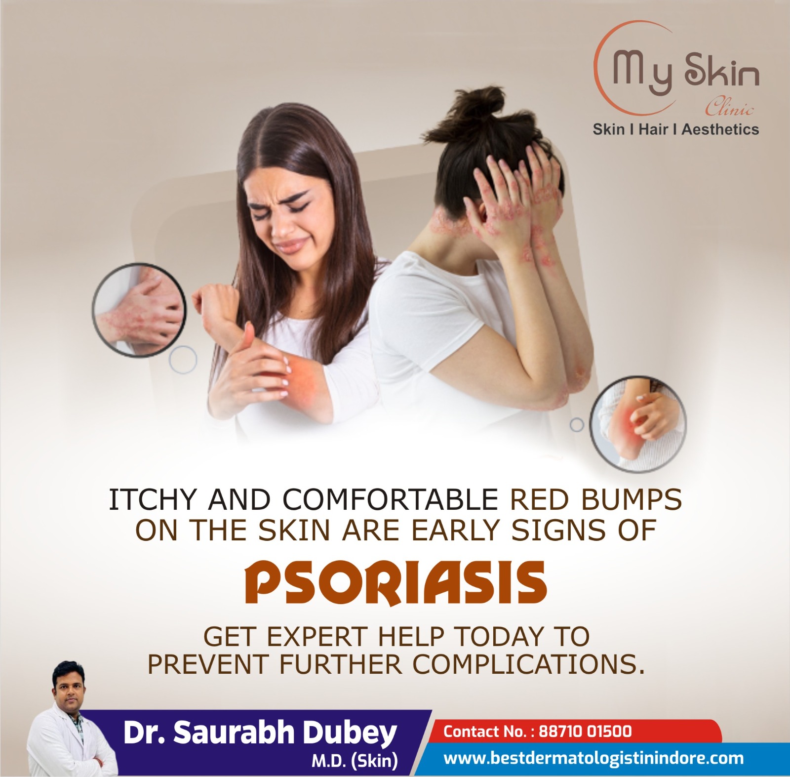 Best Skin Specialist for Psoriasis Treatment in Indore