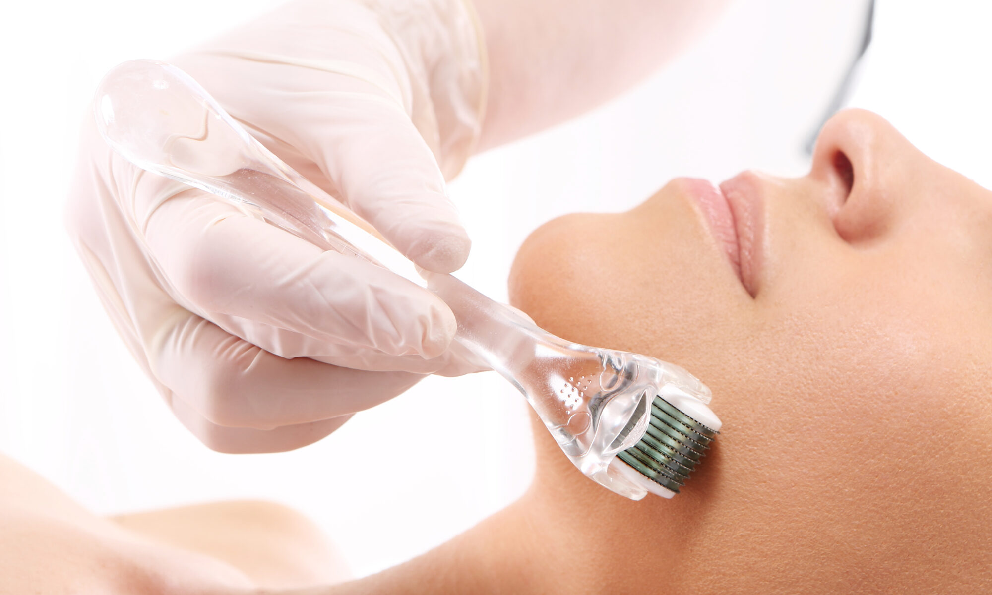 Best Clinic for Derma Roller Treatment in Indore