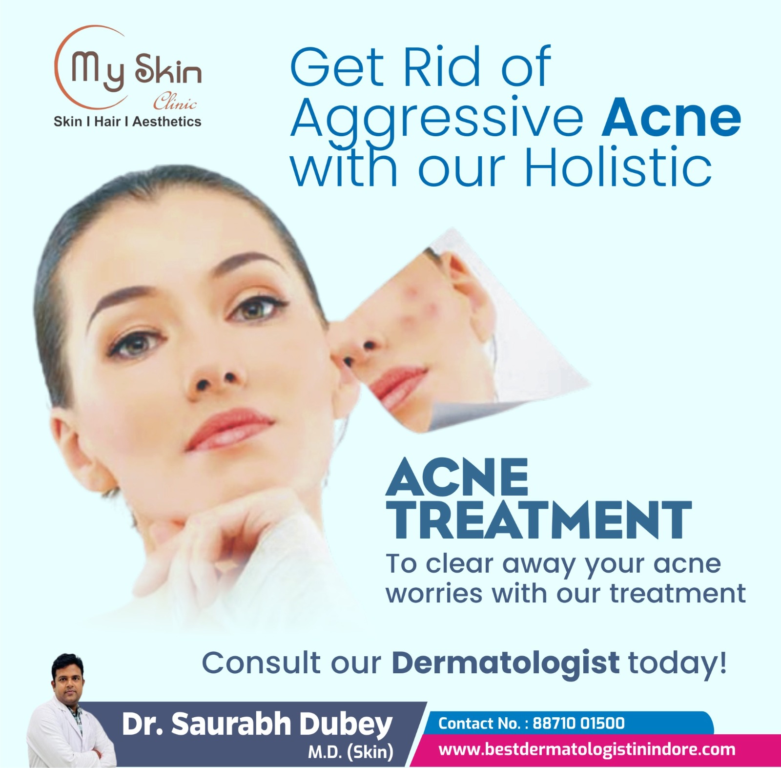 Best Skin Doctor for Acne Treatment in Indore