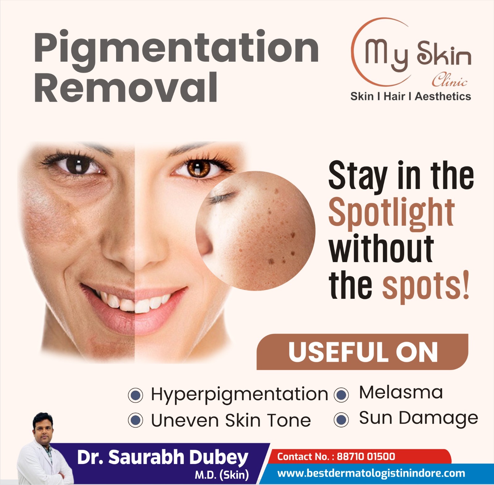 Best Skin Doctor for Pigmentation Treatment in Indore